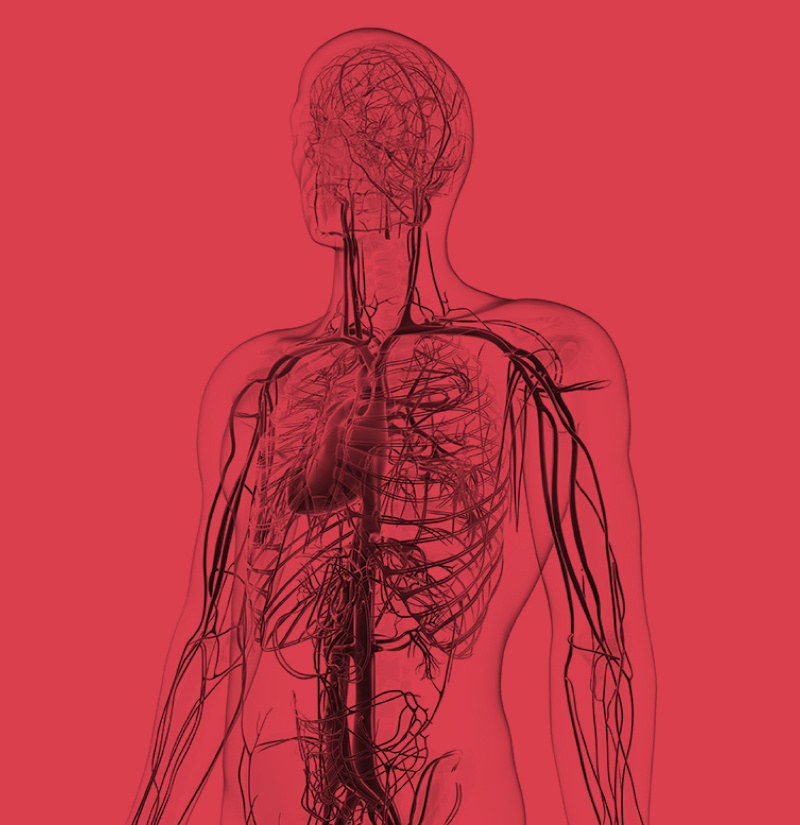 Vascular